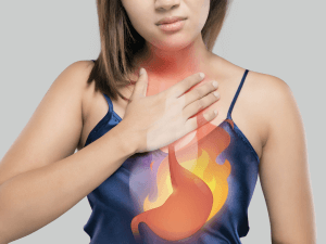 Acid Reflux Therapy and Migraine – What You Need to Know